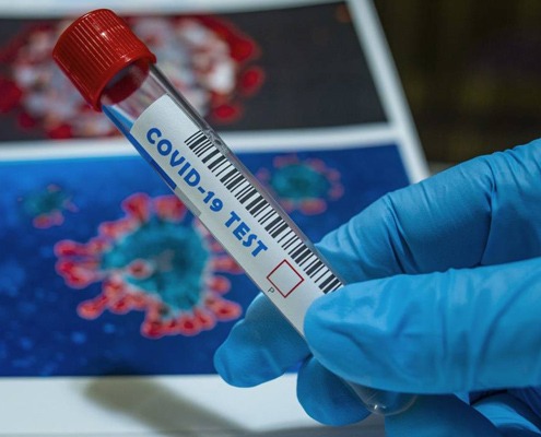 Μοριακό τεστ ανίχνευσης κορωνοϊού